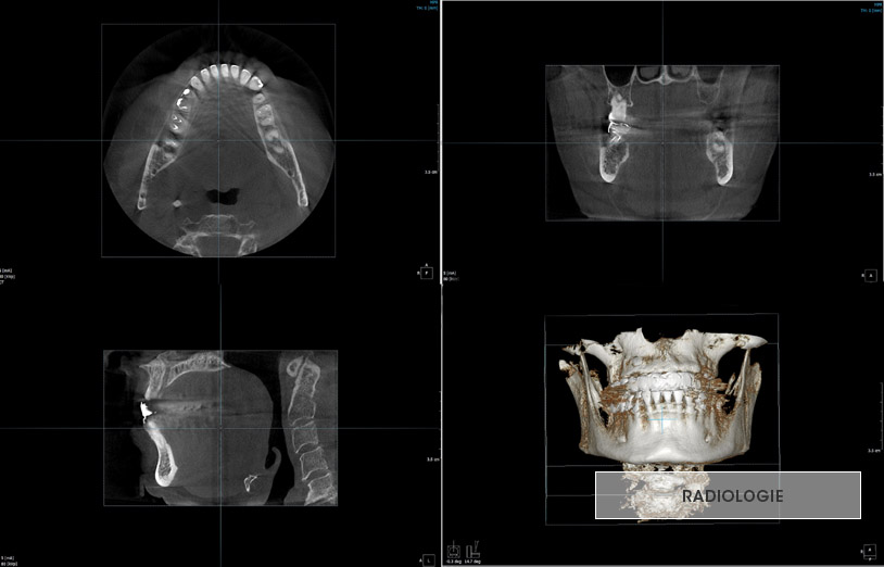 radiologie dentaire